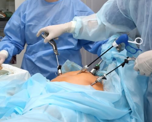laparoscopic_hernia-repair-drjaved-bengaluru